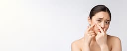 Salicylic Acid Uses in Cosmetic Formulations: How Salicylic Acid Works in Different Products