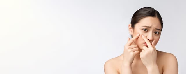 Salicylic Acid Uses in Cosmetic Formulations: How Salicylic Acid Works in Different Products